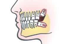 Metro Dental Health image 2
